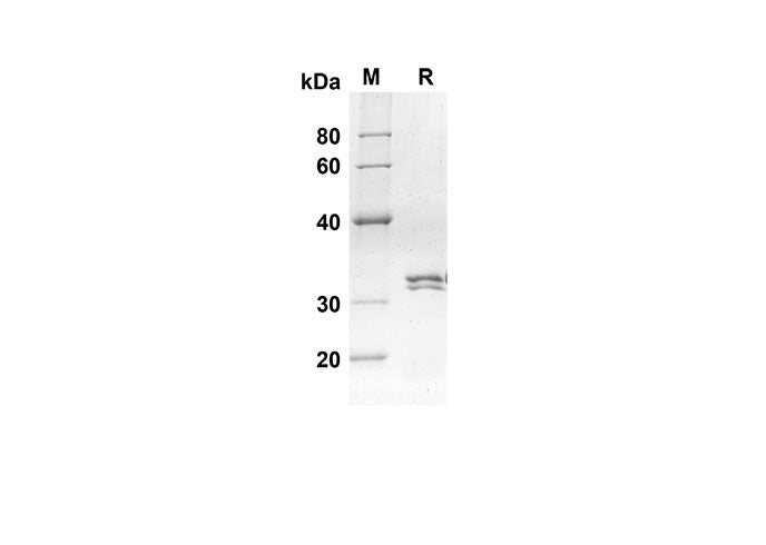 SDS-PAGE analysis of Mouse Ccl24 proteins, 2 μg/lane of Recombinant Mouse Ccl24 proteins was resolved with an SDS-PAGE under reducing conditions, showing bands at 30.1 kDa.