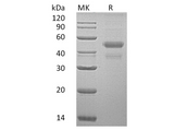 Recombinant Human ERP44 Protein (His Tag) - ABMIUM