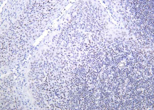 Anti-Human/Mouse/Rat Bmi-1 Antibody [B1036] - ABMIUM