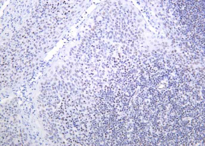 Anti-Human/Mouse/Rat Bmi-1 Antibody [B1036]