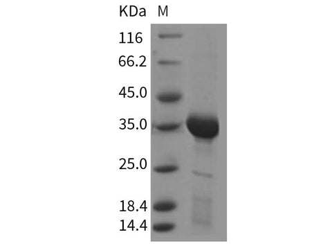 Recombinant Rat HAAO/3-HAO Protein (His Tag) - ABMIUM