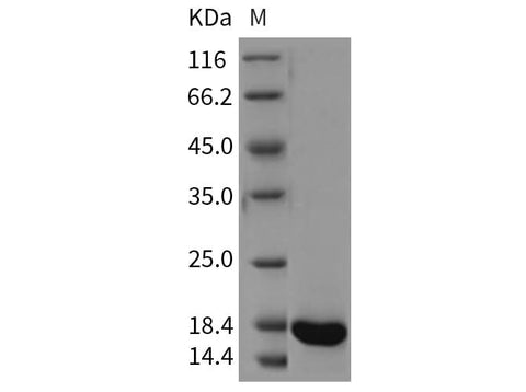 Recombinant Rat REG3A/HIP Protein (His Tag) - ABMIUM