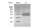 Recombinant Human NKG2A & CD94 Heterodimer Protein (His & Flag Tag) - ABMIUM