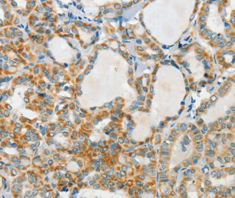 Anti-Human/Mouse/Rat AANAT Antibody - ABMIUM