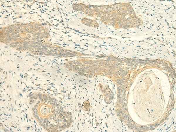 Anti-Human/Mouse/Rat MPV17 Antibody