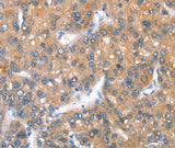 Anti-Human CD238 Antibody - ABMIUM