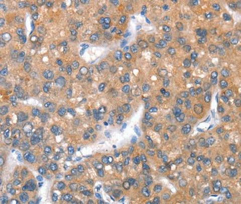 Anti-Human CD238 Antibody - ABMIUM