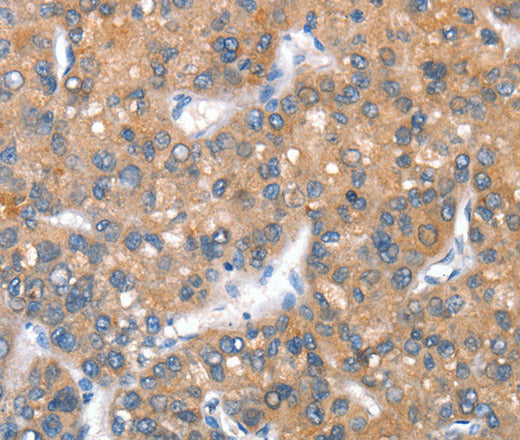 Anti-Human CD238 Antibody - ABMIUM