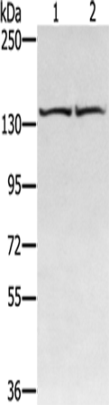 Anti-Human RGS22 Antibody - ABMIUM