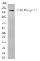 Anti-Human/Mouse/Rat VEGF Receptor 1 Antibody [B761]