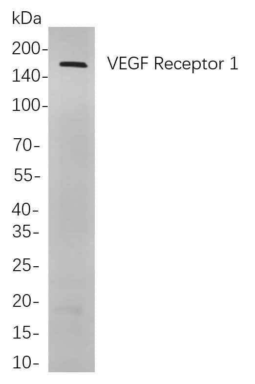 Anti-Human/Mouse/Rat VEGF Receptor 1 Antibody [B761]