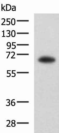 Anti-Human/Mouse/Rat SHC3 Antibody