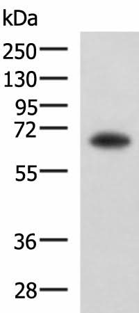 Western blot analysis of PC3 cell lysate using SHC3 Polyclonal Antibody at dilution of 1:650