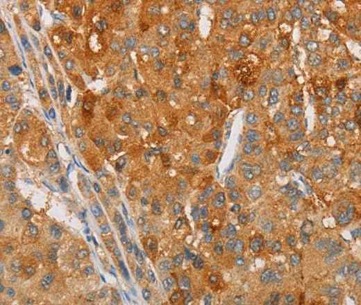 Anti-Human/Mouse/Rat ARSG Antibody