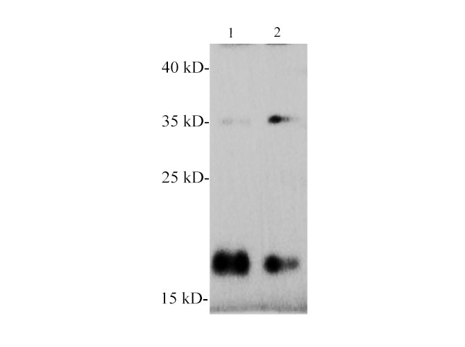 Western blotting with anti-α-Synuclein polyclonal antibody at dilution of 1:1000. Lane 1: Mouse brain lysate, lane 2: Rat brain lysate.