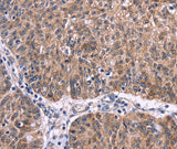 Anti-Human/Mouse/Rat Ephrin A5 Antibody - ABMIUM