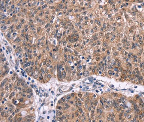 Anti-Human/Mouse/Rat Ephrin A5 Antibody - ABMIUM