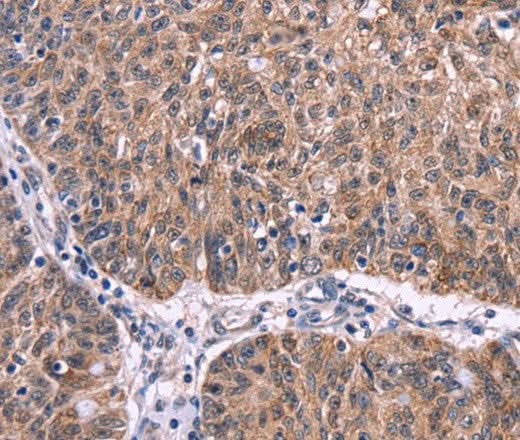 Anti-Human/Mouse/Rat Ephrin A5 Antibody - ABMIUM
