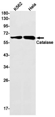 Western blot detection of Catalase in K562,Hela cell lysates using Catalase Rabbit mAb(1:1000 diluted).Predicted band size:60kDa.Observed band size:60kDa.