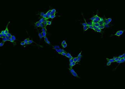 Anti-Human NCAM1 Antibody [B267] - ABMIUM