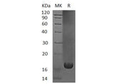 Recombinant Human UBE2V1 Protein (His Tag) - ABMIUM