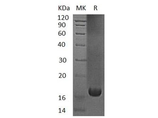 Recombinant Human UBE2V1 Protein (His Tag) - ABMIUM