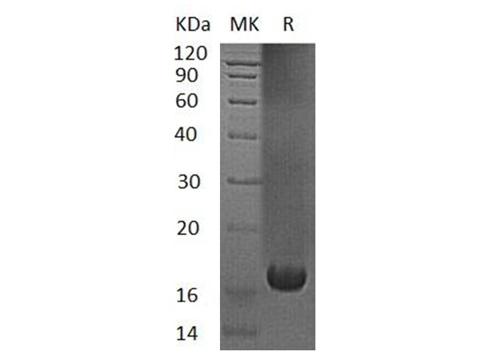Recombinant Human UBE2V1 Protein (His Tag) - ABMIUM