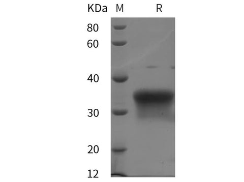 SDS-PAGE analysis of Human Oncostatin M/OSM proteins, 2 μg/lane of Recombinant Human Oncostatin M/OSM proteins was resolved with SDS-PAGE under reducing conditions, showing bands at 35 kDa.