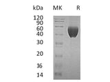 Recombinant Human FSTL1 Protein (His Tag, Human Cells) - ABMIUM