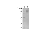 SDS-PAGE analysis of Human M-CSF R/CD115 proteins , 2 μg/lane of Recombinant Human M-CSF R/CD115 proteins was resolved with SDS-PAGE under reducing conditions , showing bands at 80 kDa.