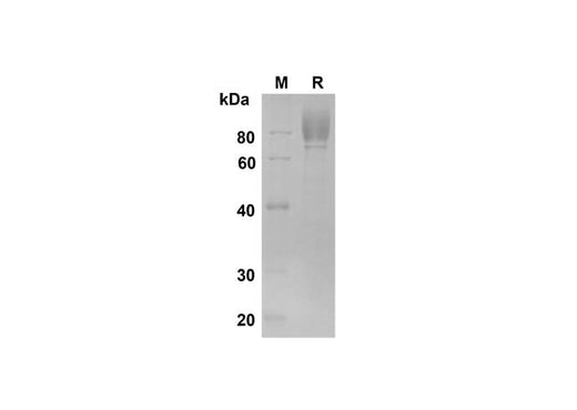 SDS-PAGE analysis of Human M-CSF R/CD115 proteins , 2 μg/lane of Recombinant Human M-CSF R/CD115 proteins was resolved with SDS-PAGE under reducing conditions , showing bands at 80 kDa.