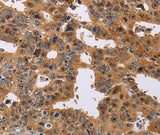Anti-Human/Mouse/Rat NIF3L1 Antibody - ABMIUM