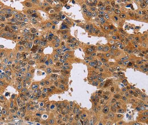 Anti-Human/Mouse/Rat NIF3L1 Antibody
