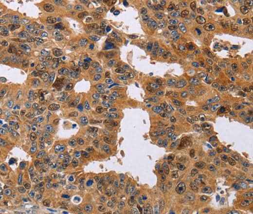 Anti-Human/Mouse/Rat NIF3L1 Antibody