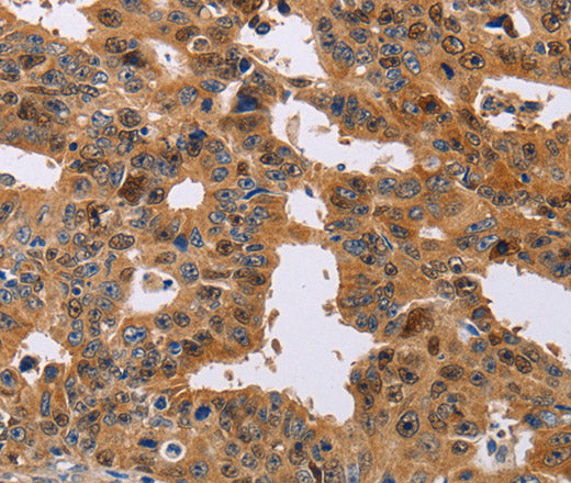 Anti-Human/Mouse/Rat NIF3L1 Antibody - ABMIUM