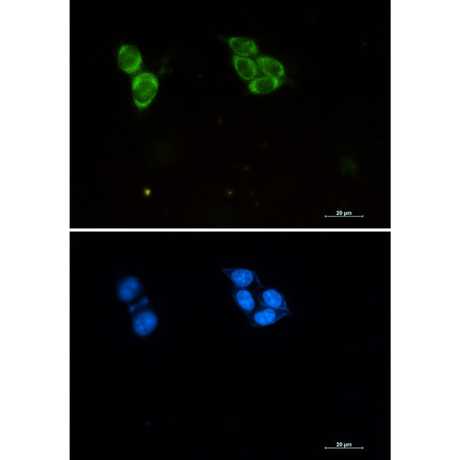 Anti-Phospho-Tau (Thr50) Rabbit Monoclonal Antibody
