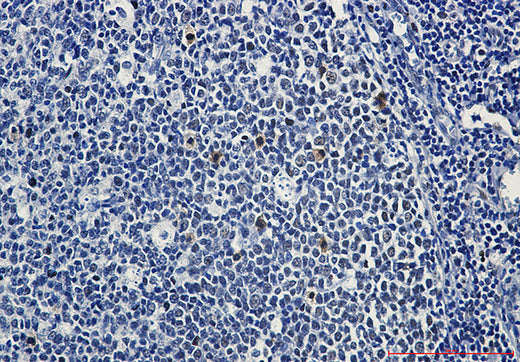 Anti-Phospho-c Myb (Ser11) Rabbit Monoclonal Antibody