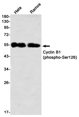 Anti-Phospho-Cyclin B1 (Ser126) Rabbit Monoclonal Antibody