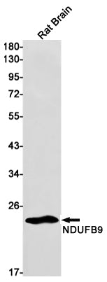 Anti-NDUFB9 Rabbit Monoclonal Antibody