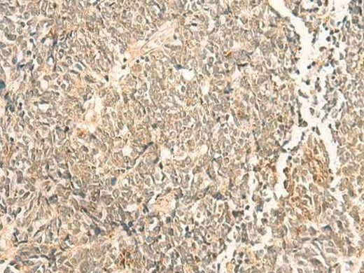 Anti-Human/Mouse/Rat NIP7 Antibody