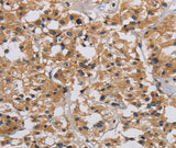 Anti-Human/Mouse/Rat INPPL1 Antibody - ABMIUM