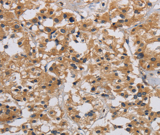 Anti-Human/Mouse/Rat INPPL1 Antibody - ABMIUM