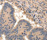 Anti-Human/Mouse/Rat BAIAP2 Antibody - ABMIUM