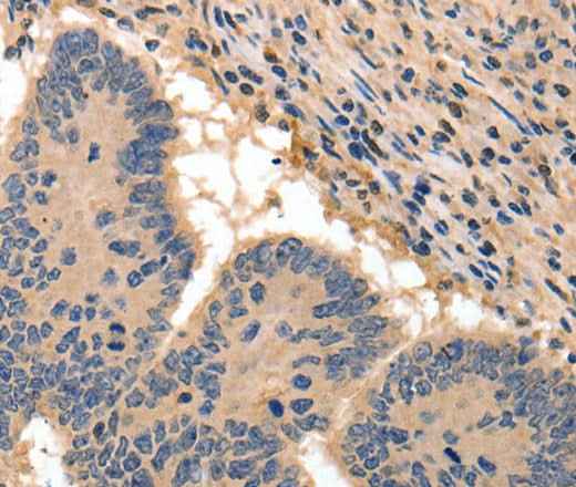 Anti-Human/Mouse/Rat BAIAP2 Antibody