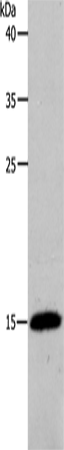 Anti-Human/Mouse/Rat PFN2 Antibody - ABMIUM