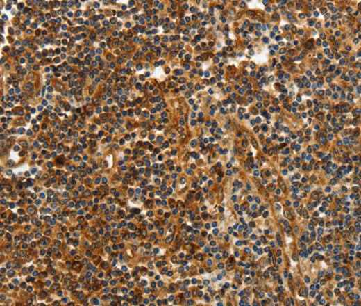 Anti-Human CNNM3 Antibody