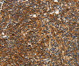 Anti-Human CNNM3 Antibody - ABMIUM
