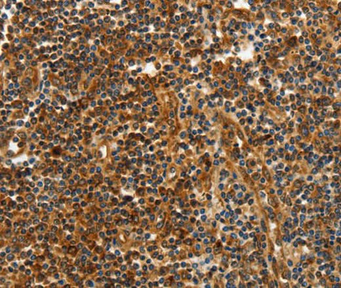 Anti-Human CNNM3 Antibody - ABMIUM