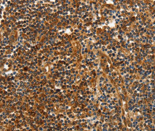 Anti-Human CNNM3 Antibody - ABMIUM