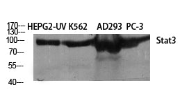 Western Blot analysis of 1) A549, 2) AD293T, 3)HepG2 cells using Stat3 Polyclonal Antibody at dilution of 1:2000.